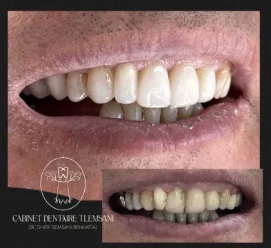 Dr Ghita Tlemsani Benhattal — Chirurgien-dentiste