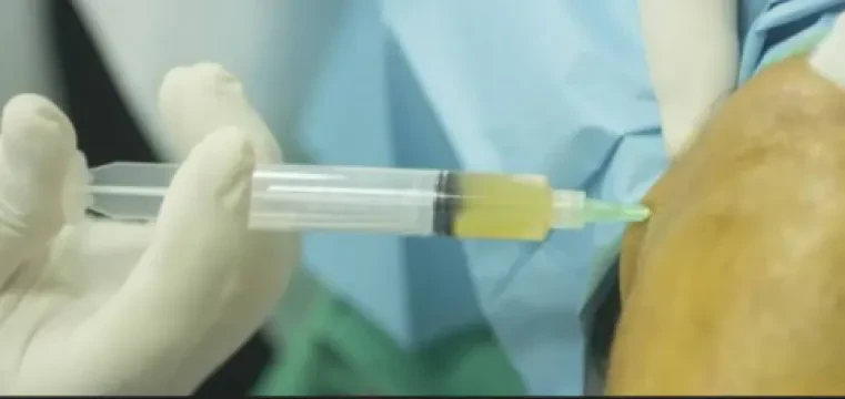 Dr Talal Grimi — Chirurgien orthopédiste et traumatologue