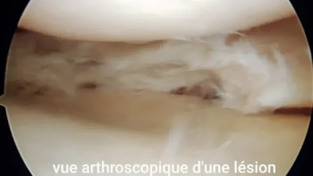 Traumatologue