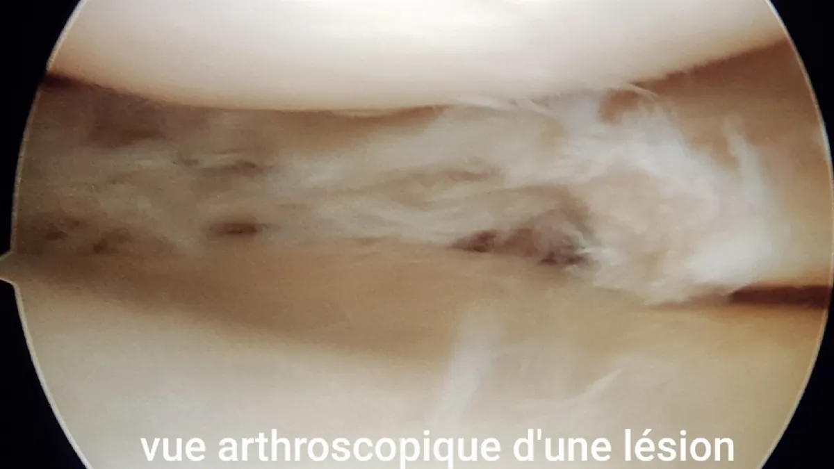 Traumatologue