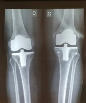 Dr Raissouni Zakariaa - Chirurgien orthopédiste