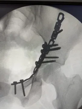 Pr Najib Abdeljaouad — Chirurgien orthopédiste