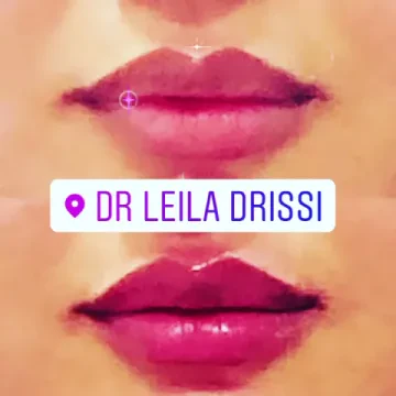 Dr Leila Drissi - Médecine esthétique
