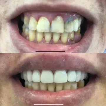 Dr Ziad Zouhair - Dentiste