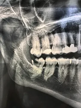 Dr Tabit Anouar - Chirurgien Dentiste