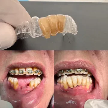Dr Tabit Anouar - Chirurgien Dentiste