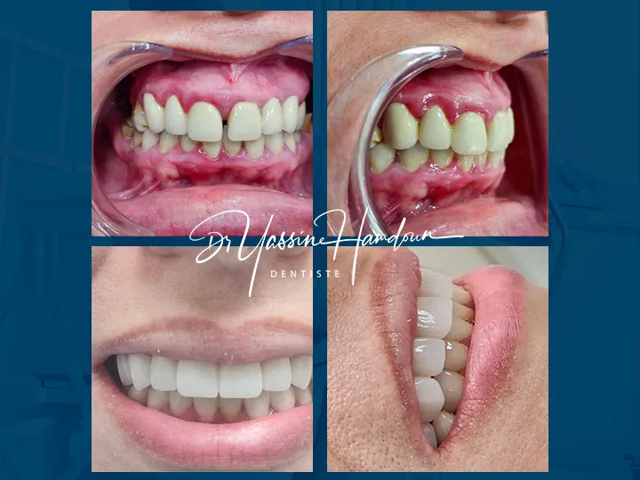 Clinique Dentaire Beauty Smile - Dr Yassine Hamdoun