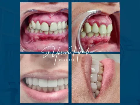 Clinique Dentaire Beauty Smile - Dr Yassine Hamdoun