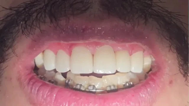 Smile's Centre Dentaire