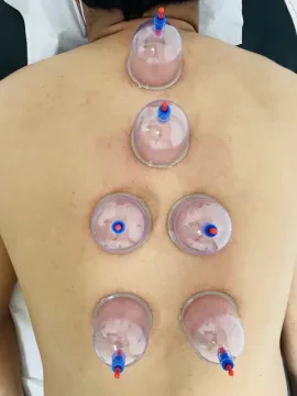 Espace Al Khair pour la Hijama