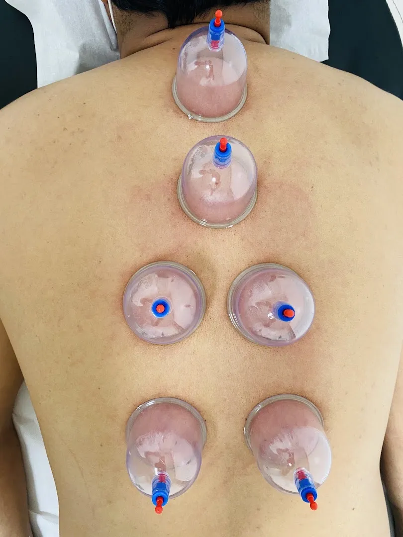 Espace Al Khair pour la Hijama
