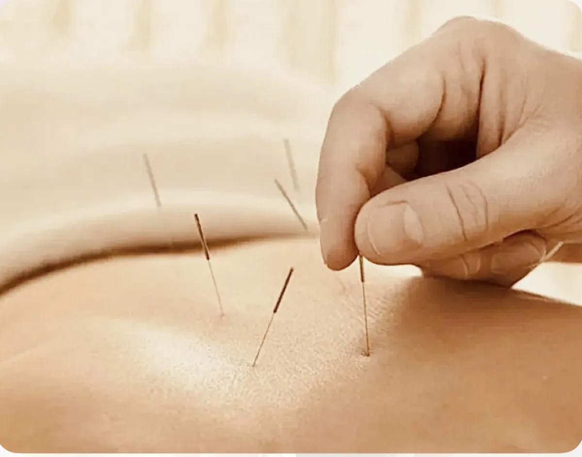 Cabinet Meftah de Kinésithérapie et Hijama médical