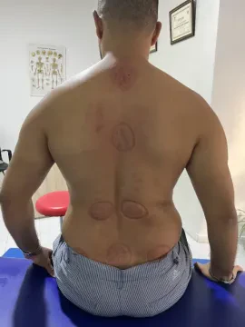 Anas Therapie