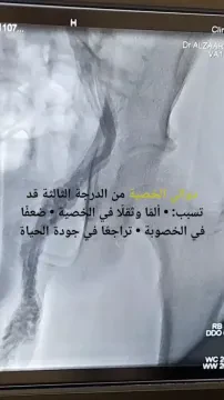 Dr Alzaarir Husam, Chirurgien vasculaire et endovasculaire