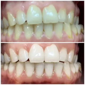 مركز دار تونسي لطب الأسنان (د. وليد التادلاوي)