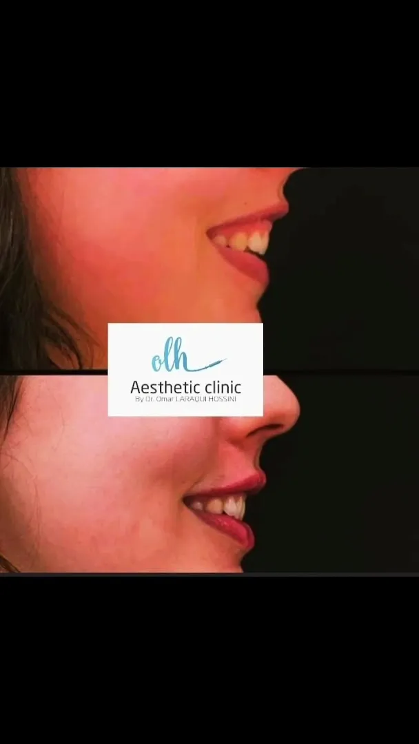 OLH Aesthetic Clinic – Dr O. Laraqui