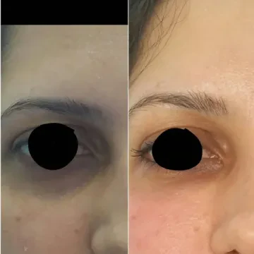 د. فالكي زكي بديعة - طب تجميلي