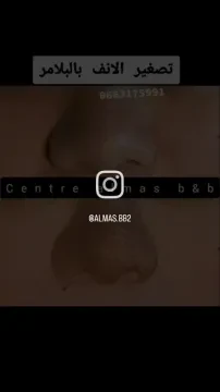 Center Almas B&B - Esthétique