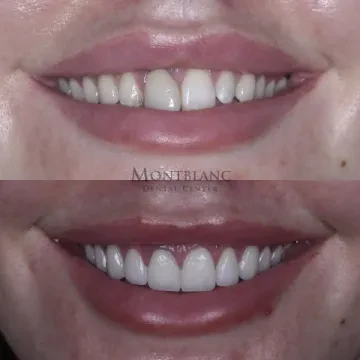 Montblanc Dental Center