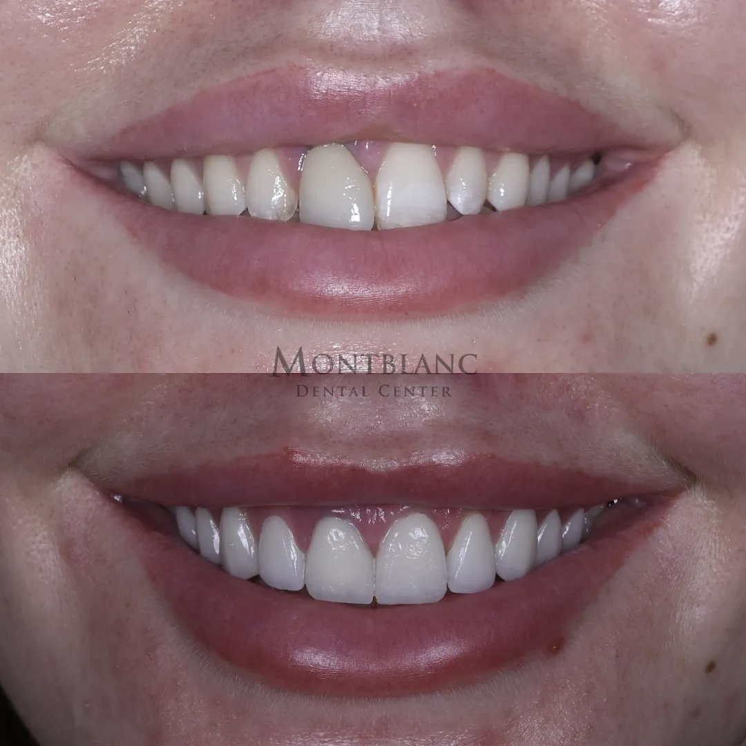 Montblanc Dental Center