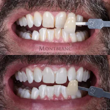 Montblanc Dental Center