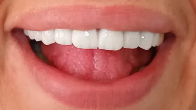 Dr Nada Saadalbichr - Chirurgien-dentiste