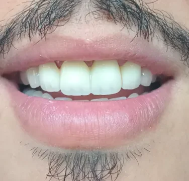 Dr Nada Saadalbichr - Chirurgien-dentiste