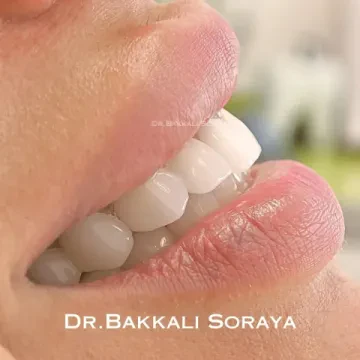 Dr Bakkali Soraya