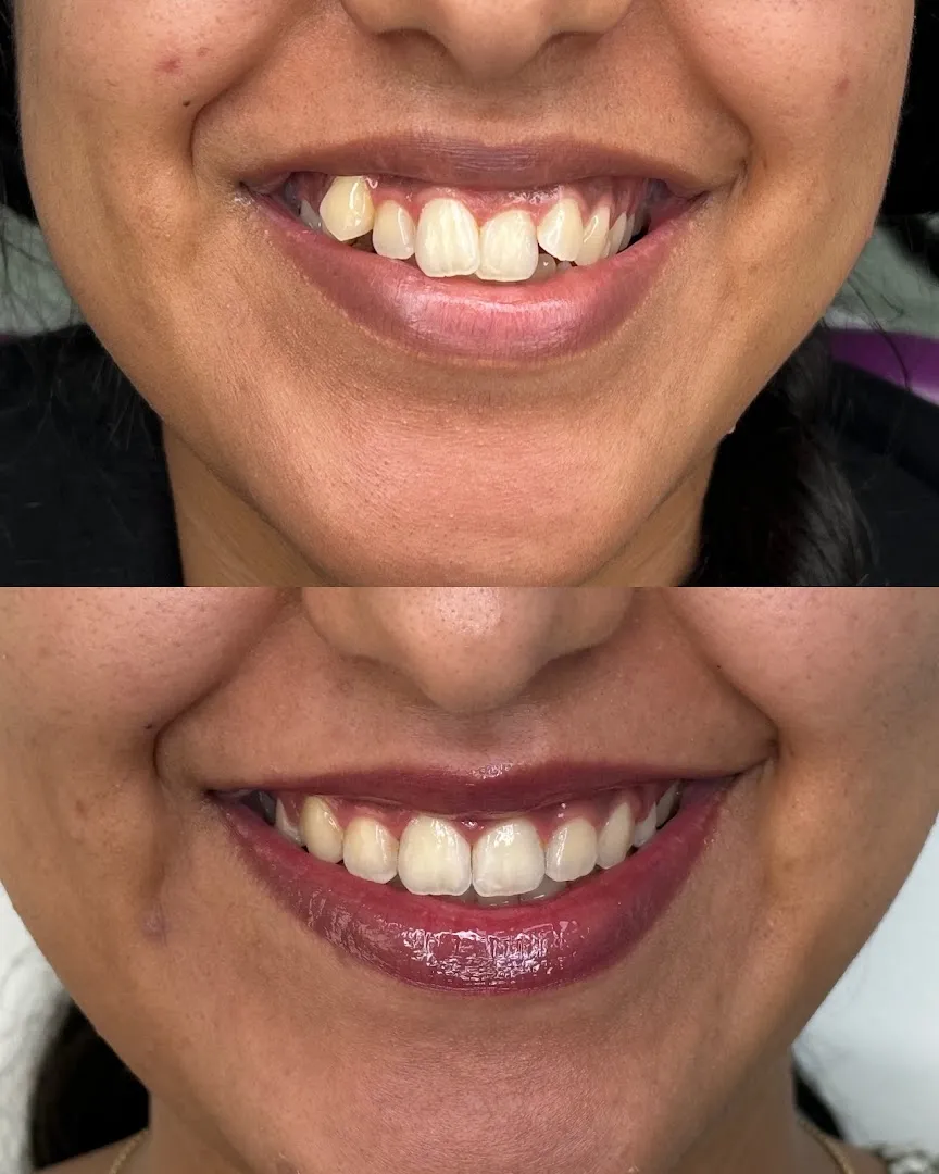 Lina Dental Center