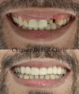 Dr Redouane Chiguer — Dentiste