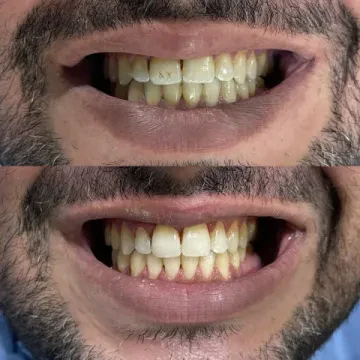 Bright Smile Dental Center