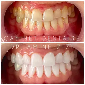 Cabinet Dentaire Dr. ZIZI Ahmed Amine