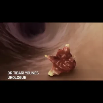 Dr Younes Tibari - Urologue
