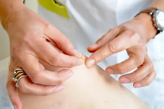 Docteur Bouchra AMMOR - Médecin Hypnothérapeute et Acupunctrice