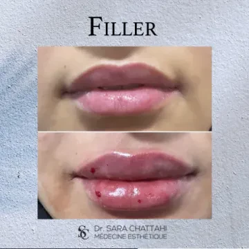 Dr Sara Chattahi Drissi