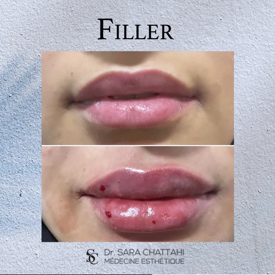 Dr Sara Chattahi Drissi