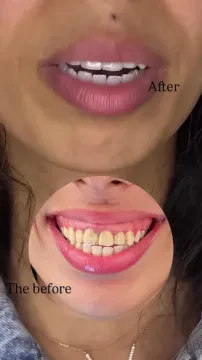 Dr Khaoula Cherkaoui — Dentiste