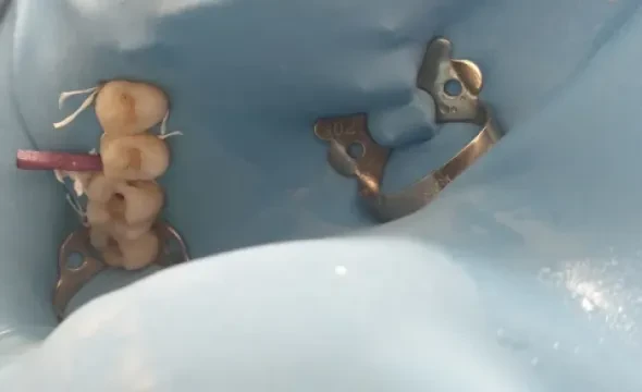 Dr Blidry Mustapha - Chirurgien-dentiste