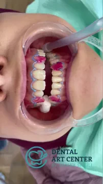 Dental Art Center, Dr Samah Sahili
