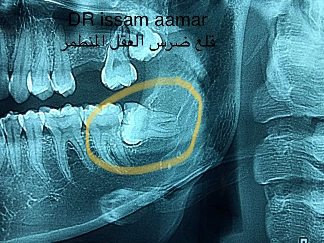 عيادة الأسنان د. عصام عمار