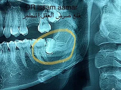 Cabinet dentaire Dr Issam Aamar