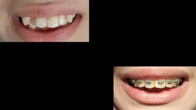 Lina Dental Center