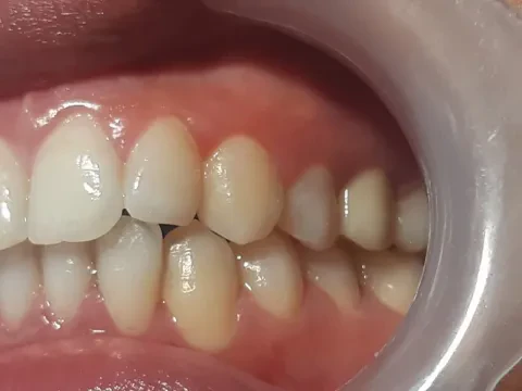 Lina Dental Center