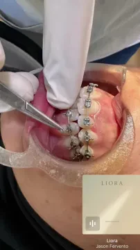 Centre dentaire Alyoussr - Dr Megrini Amine