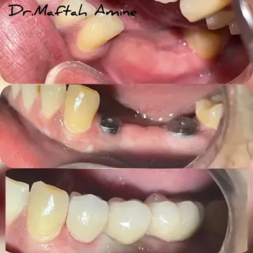 Dr Maftah Amine, Chirurgien-dentiste