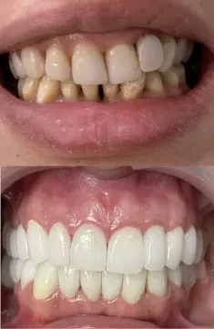 The Smile Clinic by Dr Zakaria Al Morabit