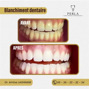 Centre Dentaire PERLA - Dr Amina Laghnane
