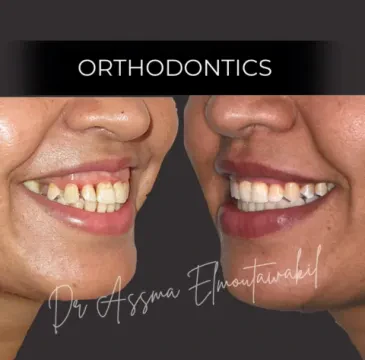 Dental Clinic – Dr Assma Elmoutawakil