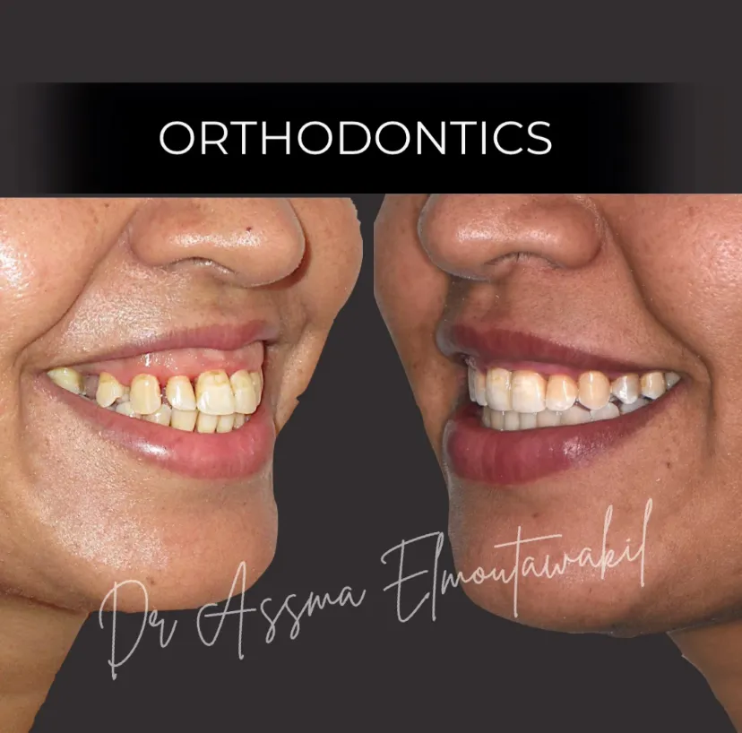 Dental Clinic – Dr Assma Elmoutawakil