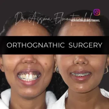 Dental Clinic – Dr Assma Elmoutawakil